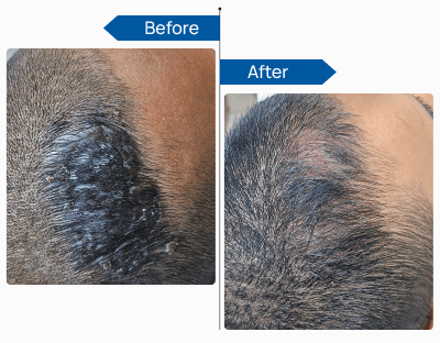 See Visible Results 1 (1)
