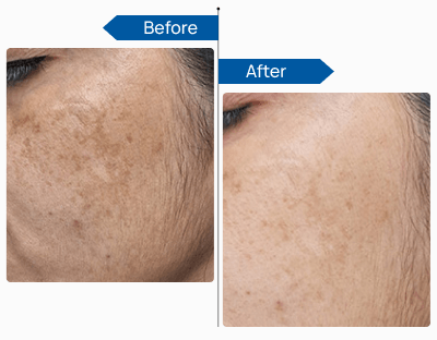See Visible Results 2 (1)