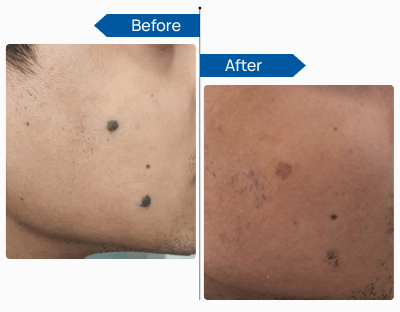 See Visible Results 3 (1)