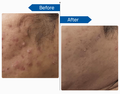 See Visible Results 4 (1)